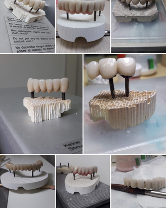Odontotecnico ceramista