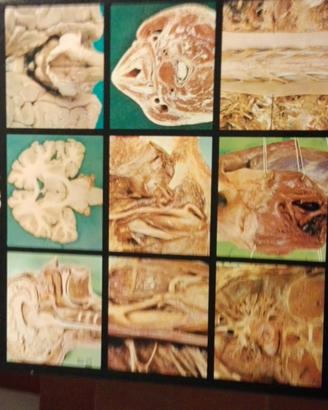 Atlanti  illustrati di anatomia umana