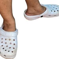 Ciabatte bianche da infermiera usate