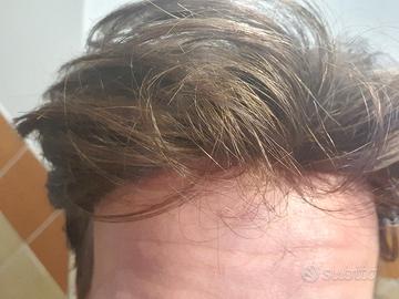 Patch Cutanea + Montaggio Low-Cost Garantito