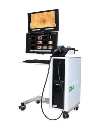 Videodermatoscopio Digitale Molemax HD