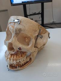 Cranio vero scomponibile di essere umano