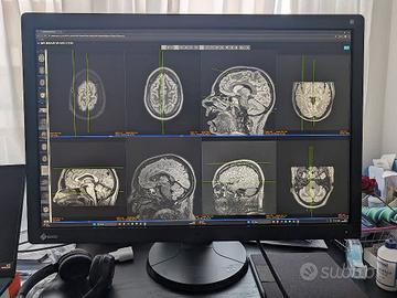 Monitor radiologia EIZO RadiForce RX650 30" 6MP
