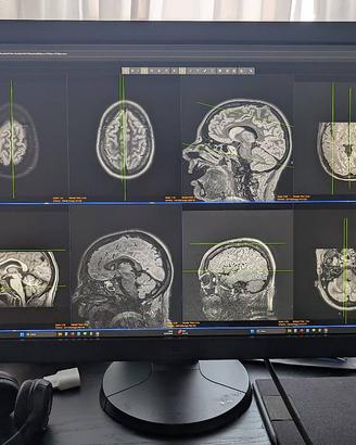 Monitor radiologia EIZO RadiForce RX650 30" 6MP