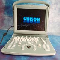 Ecografo portatile CHISON ECO1 senza sonde