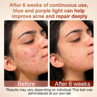 Maschera Viso anti perfezioni. Nuova mai usata