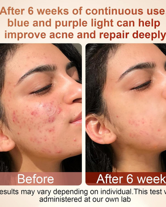 Maschera Viso anti perfezioni. Nuova mai usata