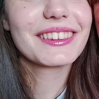Pulizie Ancona