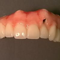 Odontotecnico a prestazione
