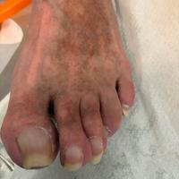 Estetista per pedicure