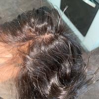 Parrucca Front Lace 100% Capelli Umani – 50 cm