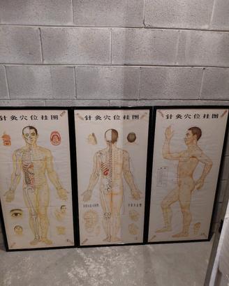 poster vintage agopuntura medicina asia
