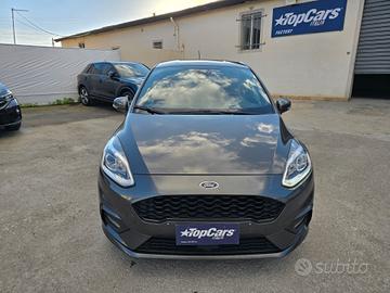 Ford Fiesta 1.5 EcoBlue ST-Line 85 cv - 2020